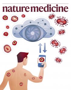 monkeypox, mpox, wissenschaft, viren, screening, wissenschaftsillustration, smartphone, KI, AI, Technik, Illustration, nature, medicine, medizin, pocken, photoapp, hautkrankheit, diagnose